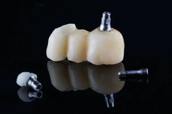 Set Coronas Dentales Defecto Fijación Elefantes — Foto de Stock