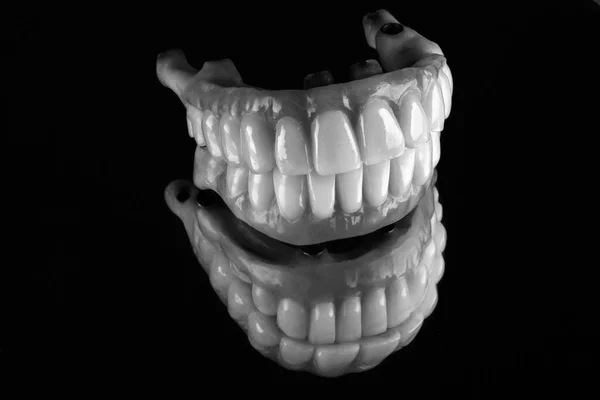 Набор Зубных Протезов Верхней Нижней Челюсти Снятый Черно Белом Стиле — стоковое фото
