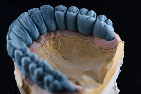 Diş Laboratuvarı Nda Kullanılmak Üzere Maviye Boyanmış — Stok fotoğraf