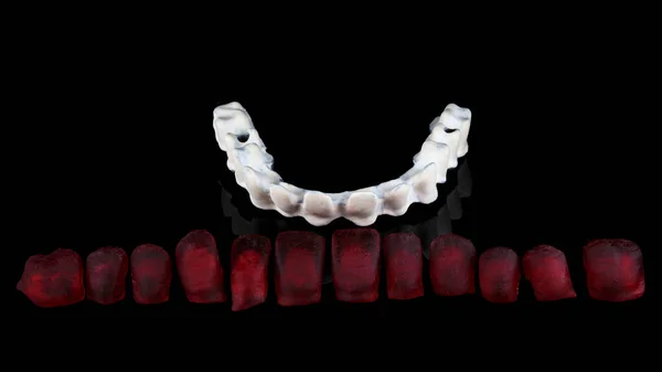 Composição Coroas Dentárias Feitas Cera Feixe Titânio Preparado Para Montagem — Fotografia de Stock