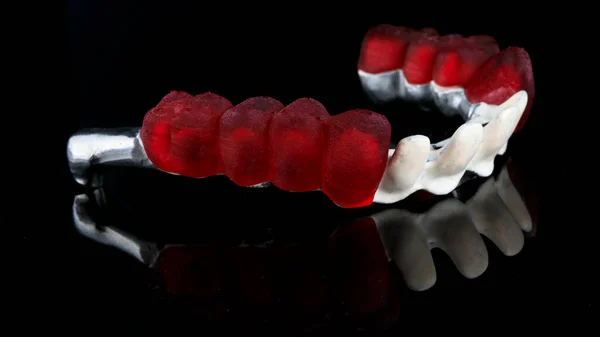Титановый Стоматологический Луч Материала Апак Красными Восковыми Коронками Жевательной Части — стоковое фото