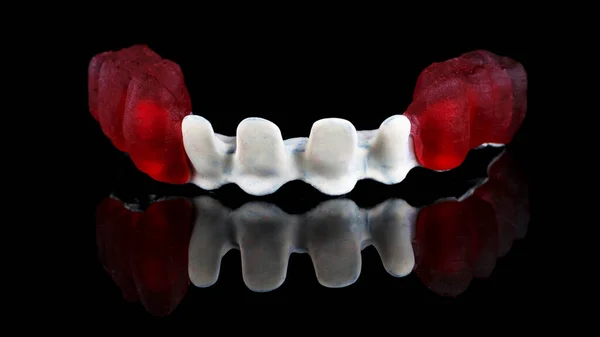 Feixe Dental Titânio Material Apak Com Coroas Cera Vermelha Temporárias — Fotografia de Stock