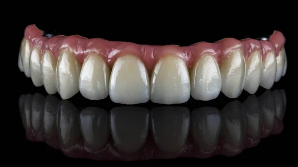 Prótese Dentária Feita Cerâmica Goma Rosa Para Mandíbula Superior Fundo — Fotografia de Stock