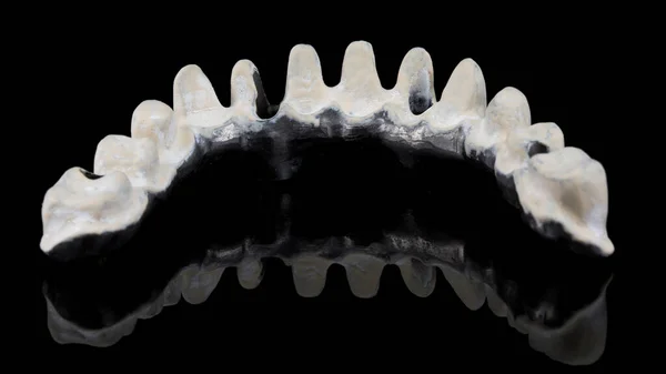 Feixe Titânio Dental Com Material Apak Mandíbula Inferior Paciente Removido — Fotografia de Stock