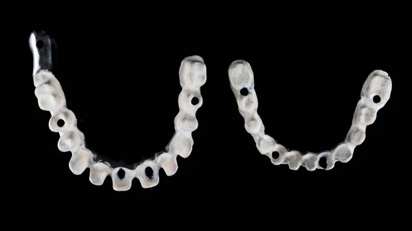 Dois Feixes Titânio Dentários Com Material Apak Nas Mandíbulas Inferior — Fotografia de Stock