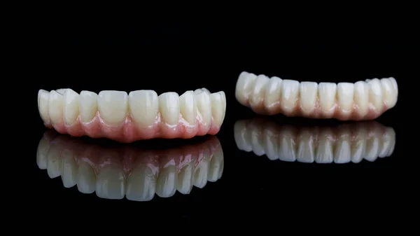 Próteses Dentárias Alta Qualidade Para Mandíbula Superior Primeiro Plano Filmadas — Fotografia de Stock