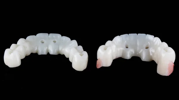 Dos Prótesis Dentales Temporales Precisas Para Toda Mandíbula Del Paciente —  Fotos de Stock