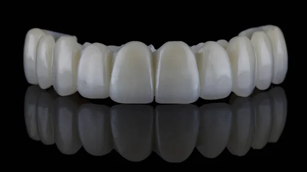 正確な歯科用高分子で作られた美しい歯科用義歯は 反射して黒い背景で撮影されました — ストック写真