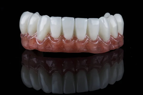 Siyah Arka Planda Çekilen Diş Polimerinin Alt Çenesinin Mükemmel Diş — Stok fotoğraf
