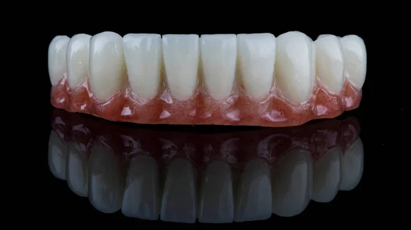 Siyah Cam Üzerinde Dişçi Alt Çene Protezinin Mükemmel Makro Fotoğrafı — Stok fotoğraf