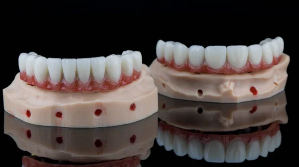 Dental Lower Jaw Prosthesis Foreground Shot Black Background Reflection — Stock Photo, Image