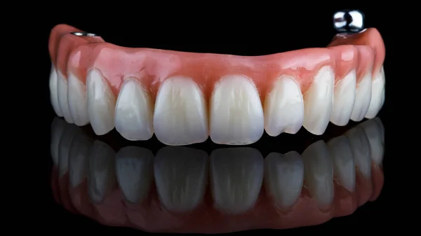 Vysoce Kvalitní Zubní Protéza Horní Čelisti Černém Skle — Stock fotografie