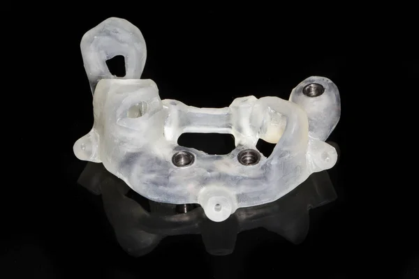 歯の移植のためのテンプレートは 患者の歯をサポートする通常のフォームではありません — ストック写真