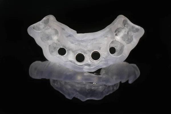 Modelo Cirúrgico Dentário Para Imlantatsii Filmado Com Bela Reflexão Vidro — Fotografia de Stock