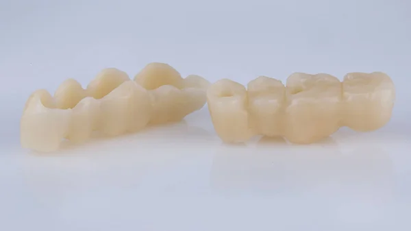 Beyaz Zemin Üzerinde Plastik Polimerden Geçici Diş Köprüleri — Stok fotoğraf
