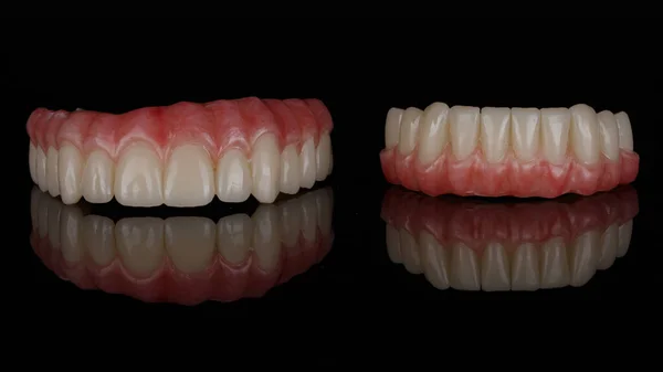 一時的な歯科医反射と黒ガラスの上にバラの歯茎と上下の顎 — ストック写真