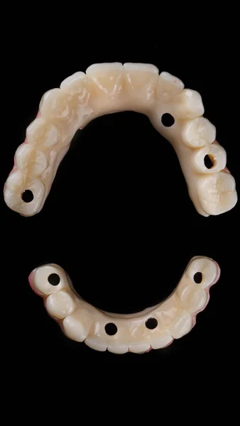 Vista Superior Prótesis Dentales Temporales Mandíbulas Superiores Inferiores Sobre Fondo —  Fotos de Stock