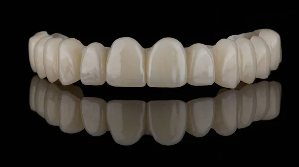 黒い背景の上顎のための歯科補綴物 — ストック写真