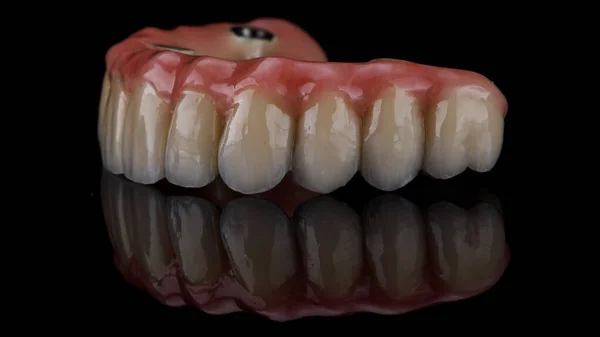 Зубной Протез Верхней Челюсти Металла Керамики Черном Стекле Отражением — стоковое фото