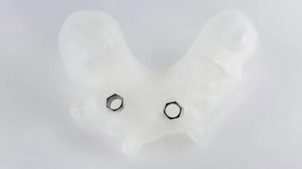 Modello Dentale Plastica Installazione Due Impianti Sfondo Bianco — Foto Stock