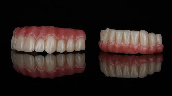 Two Prostheses Upper Lower Jaw Artificial Gums Black Background — Stock Photo, Image