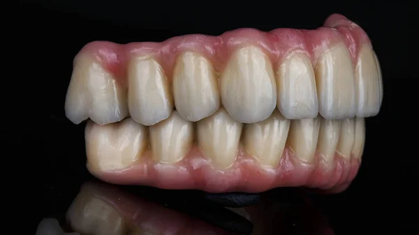 黒の背景にピンクのガムで2本の歯の前立腺があり — ストック写真