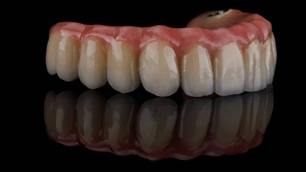 上顎の歯列矯正のマクロ写真で反射性に優れています — ストック写真