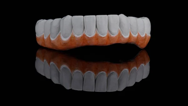 Zircone Dentale Creare Una Protesi Della Mascella Inferiore Con Una — Foto Stock