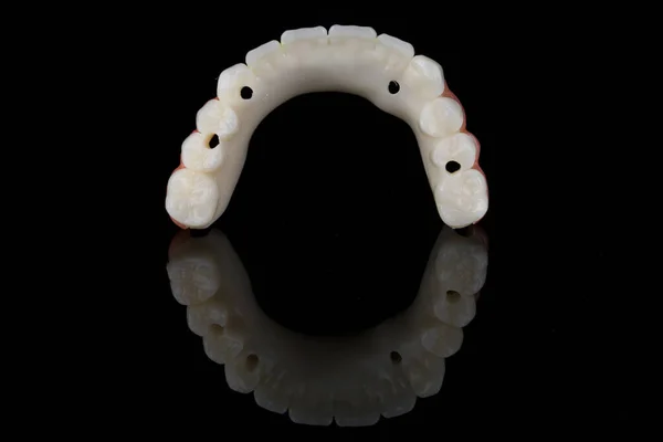 Temporary Prosthesis Upper Jaw Form Arc Black Glass Reflection — Stock Photo, Image