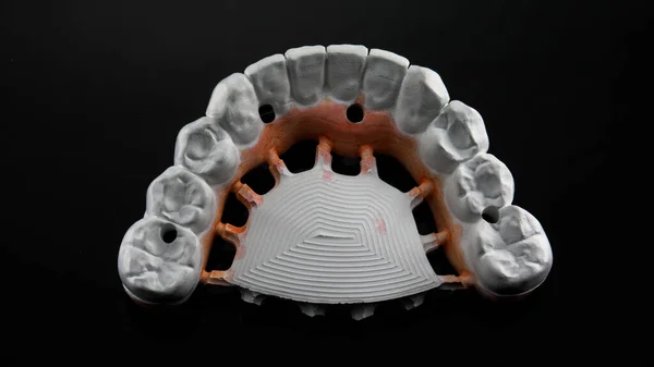 機械を粉砕した後のジルコン歯科補綴物の第1段階黒い背景を持つ形態学のトップビュー — ストック写真