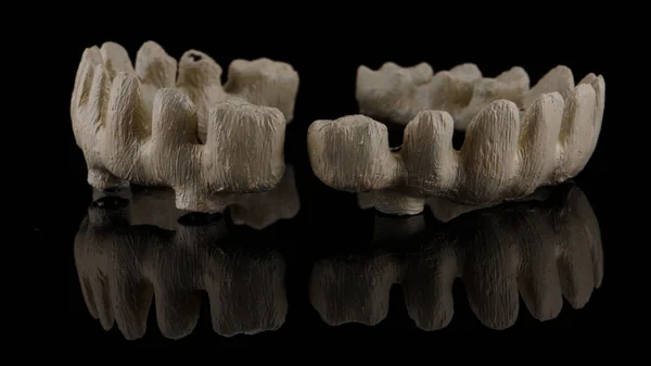 Excelente Composición Dos Barras Dentales Titanio Vidrio Negro —  Fotos de Stock