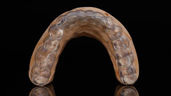 Beautiful Dental Cap Lower Jaw Made Transparent Polymer Model Shot — Stock Photo, Image