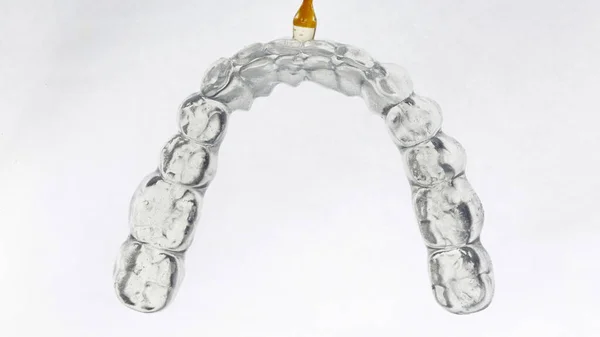 Arch Dental Cap Made Transparent Polymer Lower Jaw Light Background — Stock Photo, Image