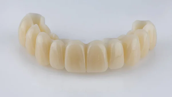 Prótese Dentária Temporária Mandíbula Superior Partir Polímero Sobre Fundo Branco — Fotografia de Stock