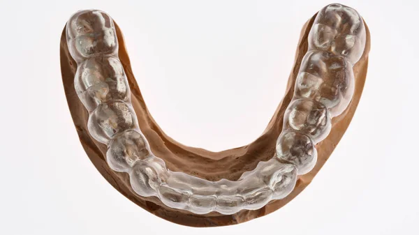 Tampa Dental Feita Plástico Modelo Mandíbula Inferior Para Montagem Fundo — Fotografia de Stock