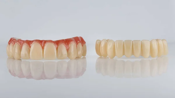 Prótesis Dentales Mandíbula Superior Inferior Sobre Fondo Blanco Con Reflejo —  Fotos de Stock