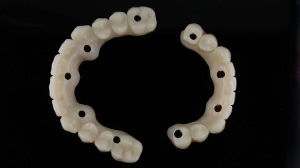 Próteses Dentárias Temporárias Feitas Plástico Polímero Vista Superior Sobre Fundo — Fotografia de Stock