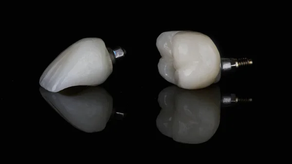 Dwie Piękne Korony Zębowe Centralnego Tylnych Zębów Czarnym Szkle Odbiciem — Zdjęcie stockowe