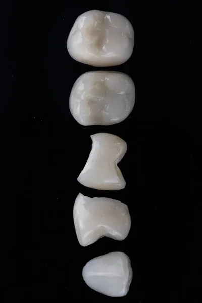 Macro Foto Dentale Cinque Corone Ceramica Vista Dall Alto Sfondo — Foto Stock
