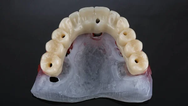 Üst Çenenin Diş Protezinin Güzel Bileşimi Siyah Arkaplandaki Dişlerin Anatomisi — Stok fotoğraf