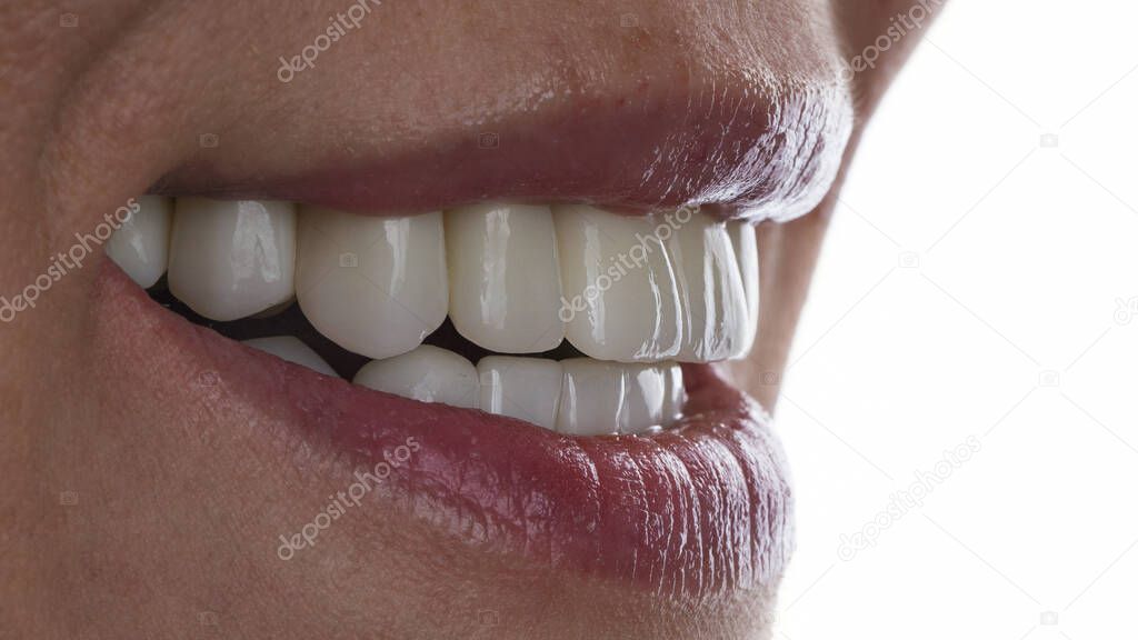 great smile of a girl with veneers and texture on her teeth