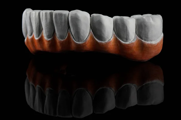 Milled Zircon Dental Prosthesis Black Background Creative Reflection — Zdjęcie stockowe