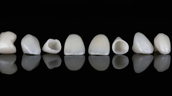 Μακροεντολή Φωτογραφία Οδοντιατρική Κεραμικά Καπλαμάδες Και Ένθετα Μαύρο Γυαλί Αντανάκλαση — Φωτογραφία Αρχείου