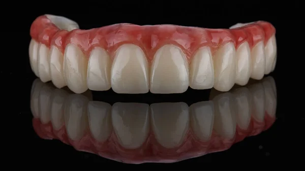 Превосходный Зубной Протез Деснами Верхней Челюсти Черном Стекле Отражением — стоковое фото