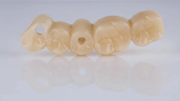 Temporary Bridge Prosthesis Made Polymer Plastic Form Chewing Teeth White —  Fotos de Stock