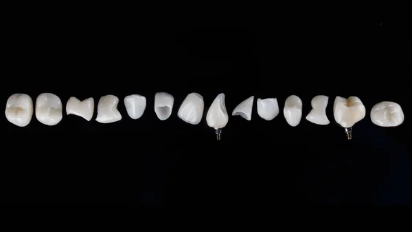 Row Ceramic Dental Veneers High Quality Crowns Shot Black Background — Fotografia de Stock