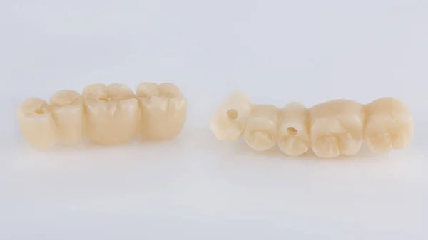Two Temporary Dental Prosthesis Bridges Made Plastic Chewing Teeth Filmed — Stok fotoğraf