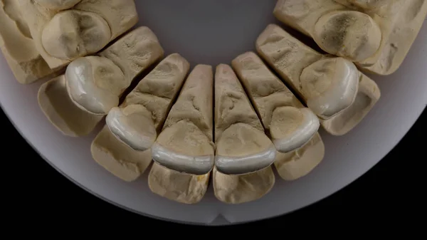 Excellent Angle Dental Veneers Top View Model Upper Jaw Taken — Fotografia de Stock
