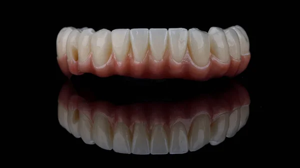 Beautiful Dental Lower Jaw Prosthetic on Black Glass With Reflection