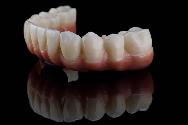 Dental Ceramics Lower Jaw Prosthetic Side View Black Glass Reflection — ストック写真